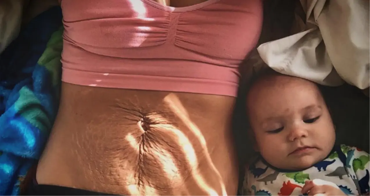 Doğum Sonrası Depresyon Yaşayan Kadının Pozu Fenomen Oldu