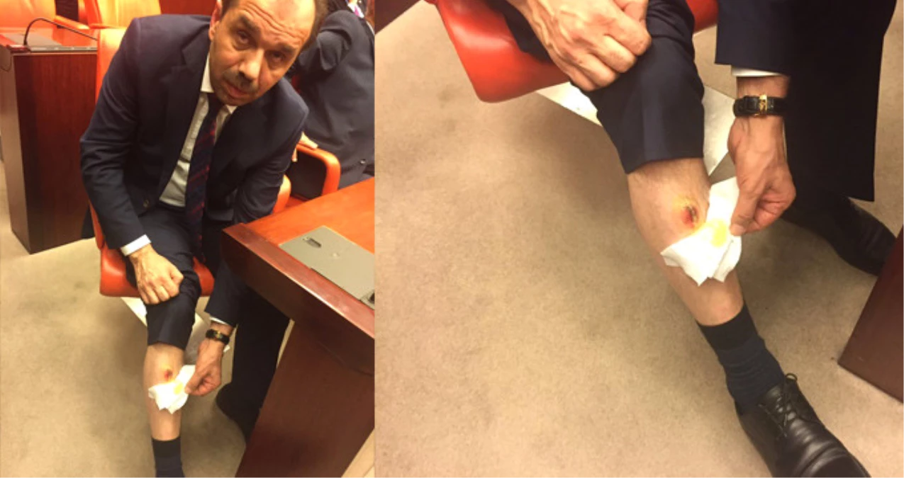 Dha Ankara - Meclisteki Isırılma Olayıyla İlgili Soruşturma Başlatıldı