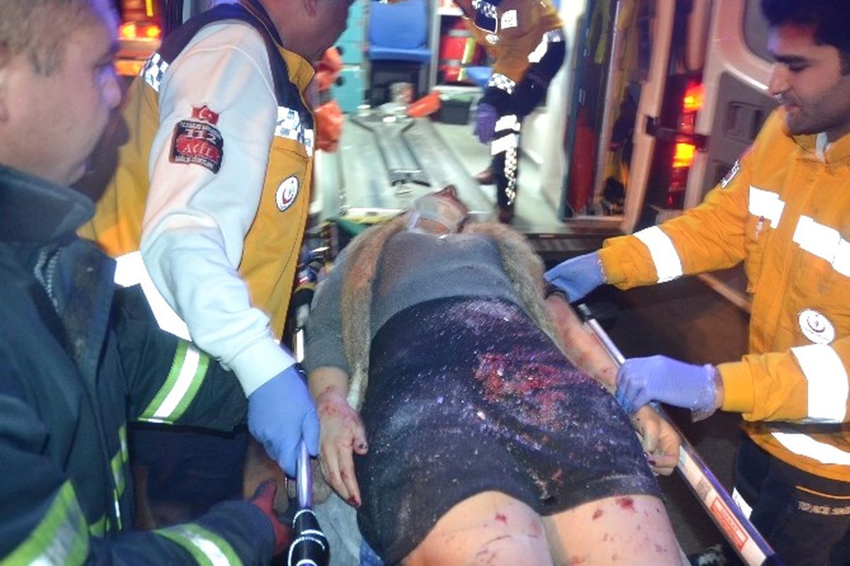 Adana\'da Direksiyon Hakimiyetini Kaybeden Otomobil, Park Halindeki Kamyonetlere Çarptı: 1 Kişi Ağır...