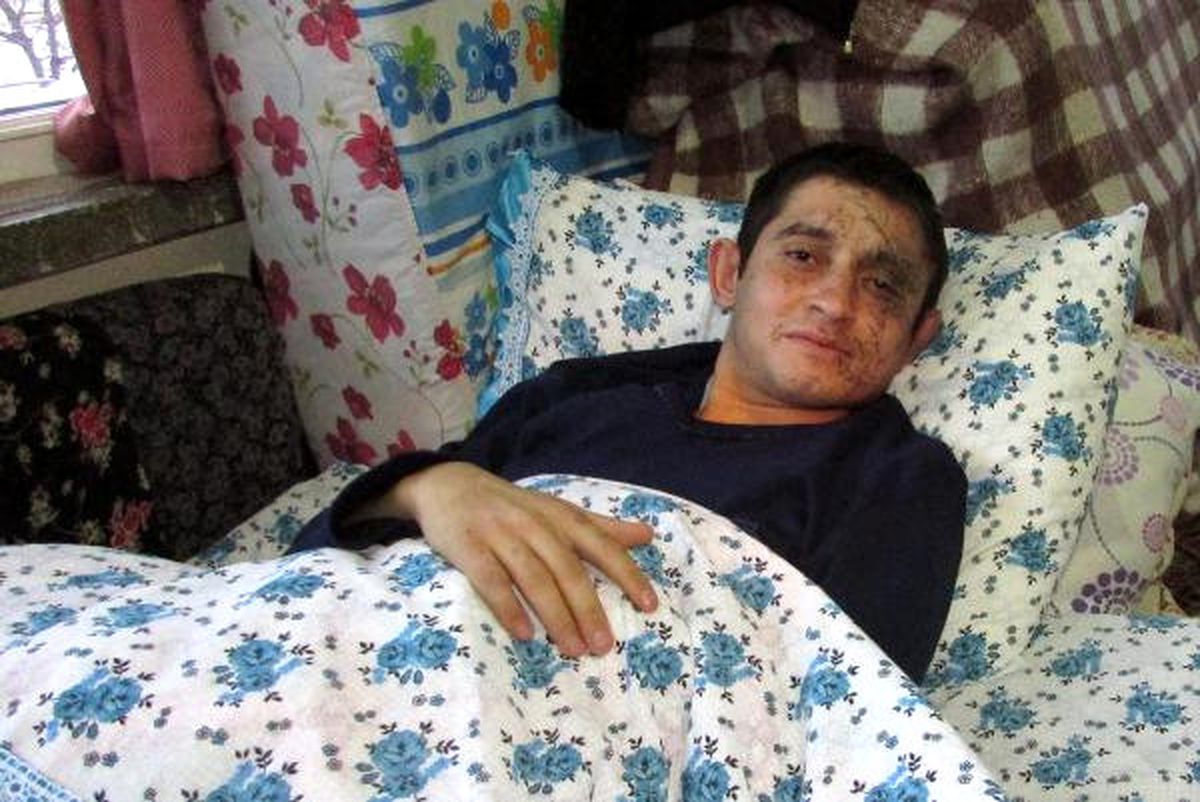 Kayseri\'deki Hain Saldırıda Yararlanan Er: Geçici Görme Kaybı Yaşadım