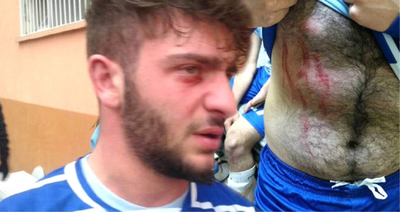 Rize\'de Amatör Futbol Maçında Kavga Çıktı, 2 Futbolcu Yaralandı