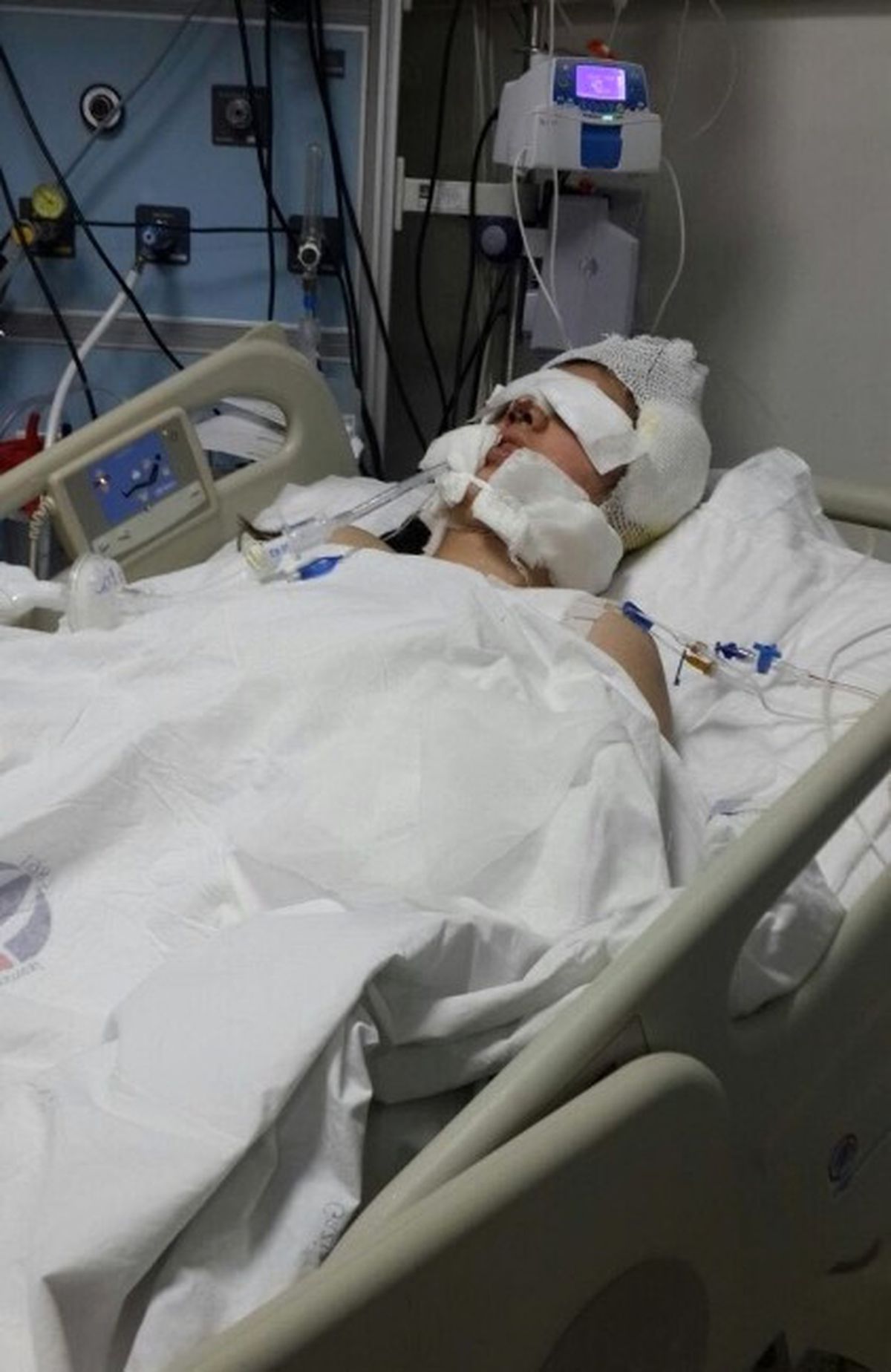 Burun Ameliyatı Olan Genç Kız, Yaşamını Yitirdi