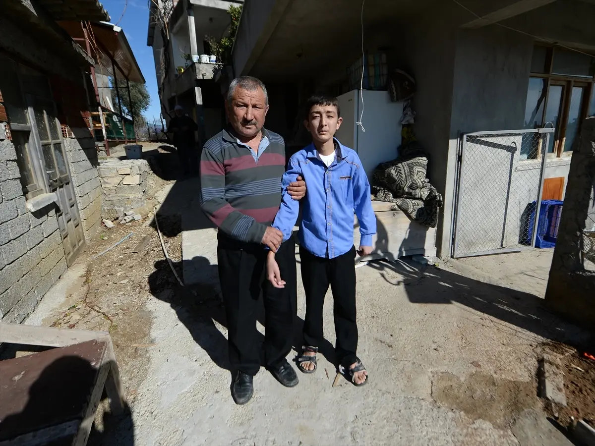 Hastalığı Milyonda Bir Görülüyor! 20 Yaşındaki Genç Eriyip Bitiyor