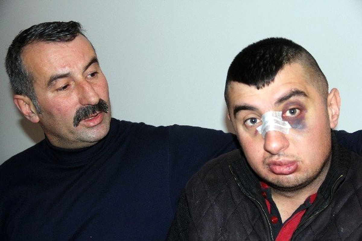Darbedilen Zihinsel Engelli ve Ailesine Devlet Sahip Çıktı