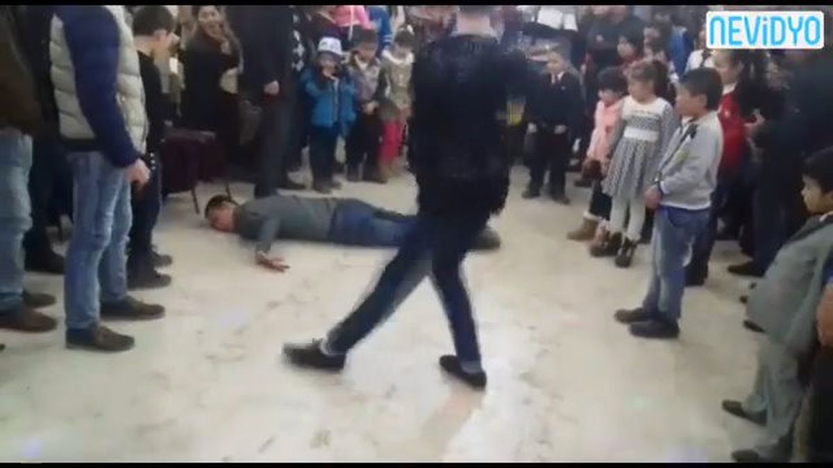 İlgi Çekmek İsterken Canından Oluyordu!