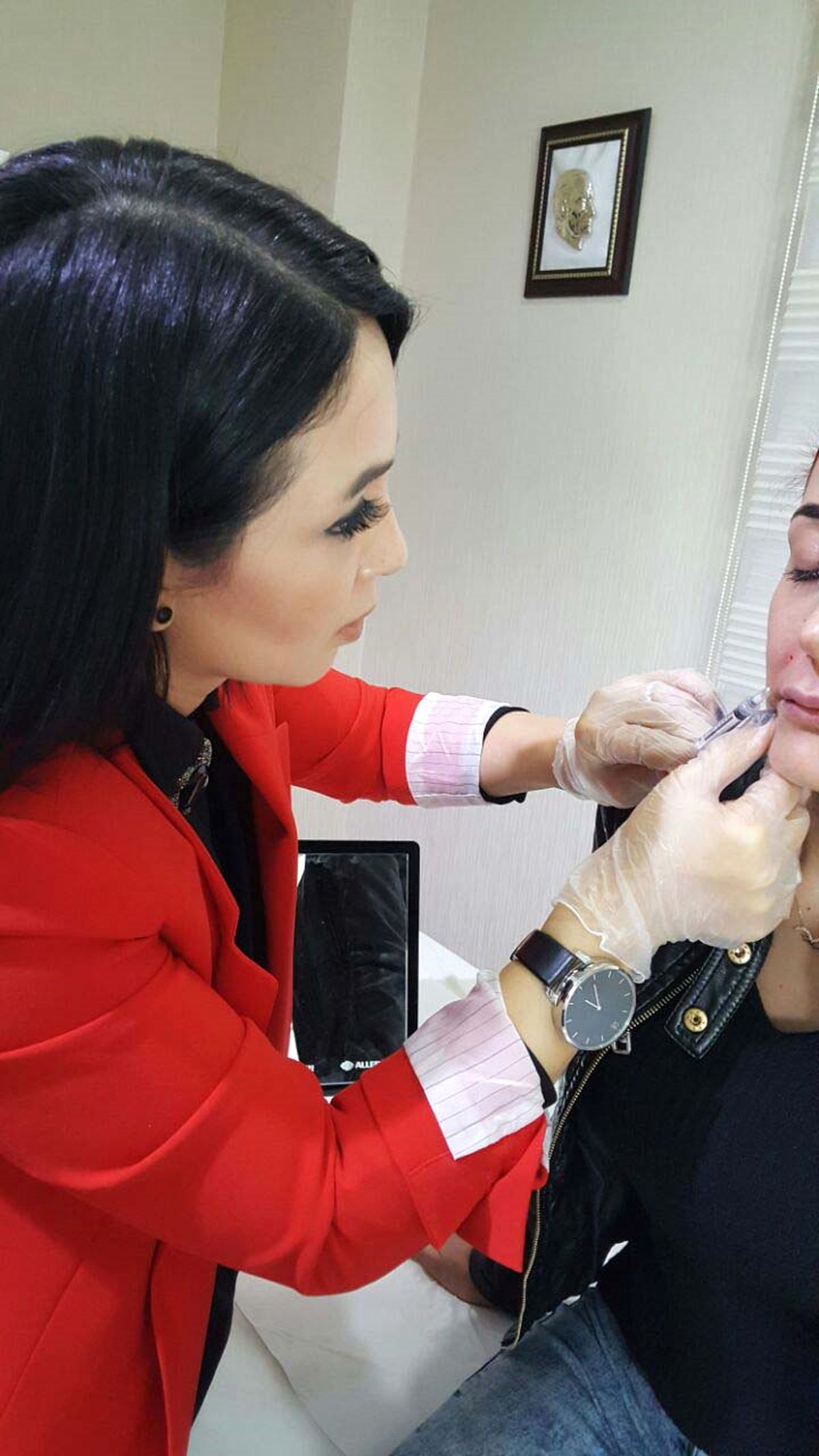 Kendi kollajeninizle gençleşin Akıllı dolgu: Ellanse