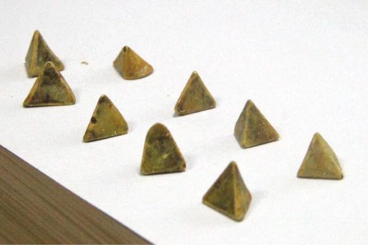 Safra Kesesinden Çıkan Piramit Şeklindeki Taşlar Şaşırttı