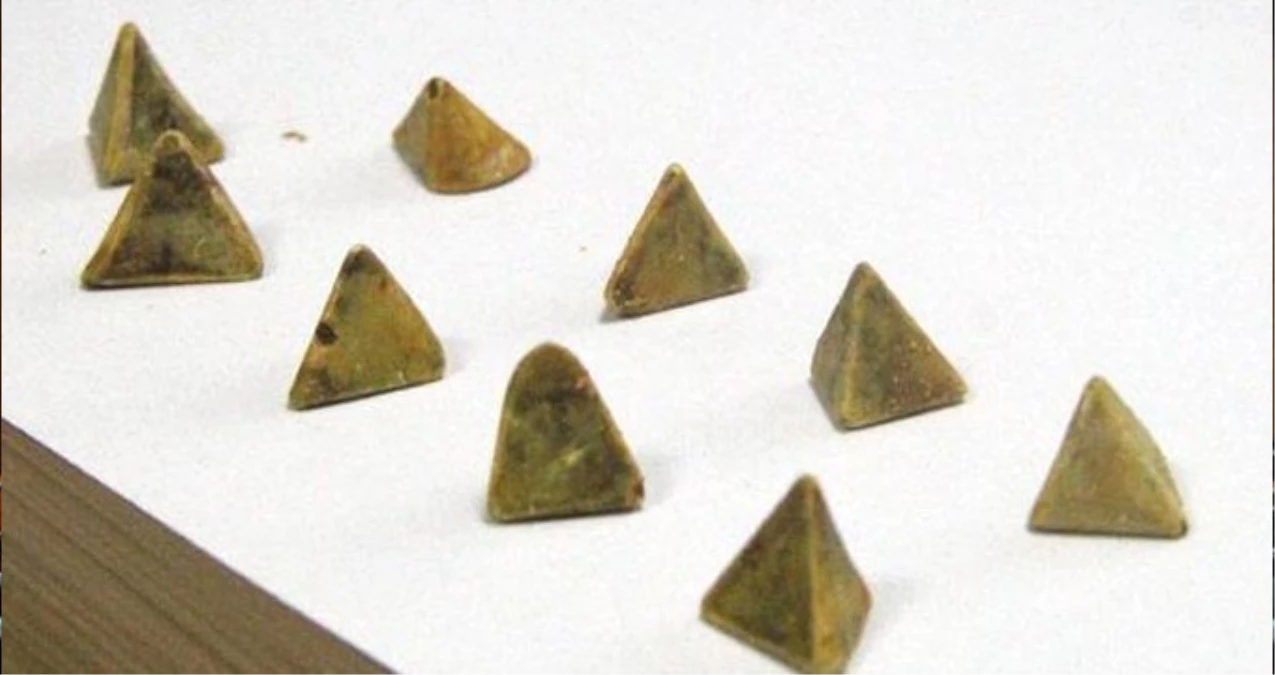 Safra Kesesinden Çıkan Piramit Şeklindeki Taşlar Doktorları Bile Şaşırttı