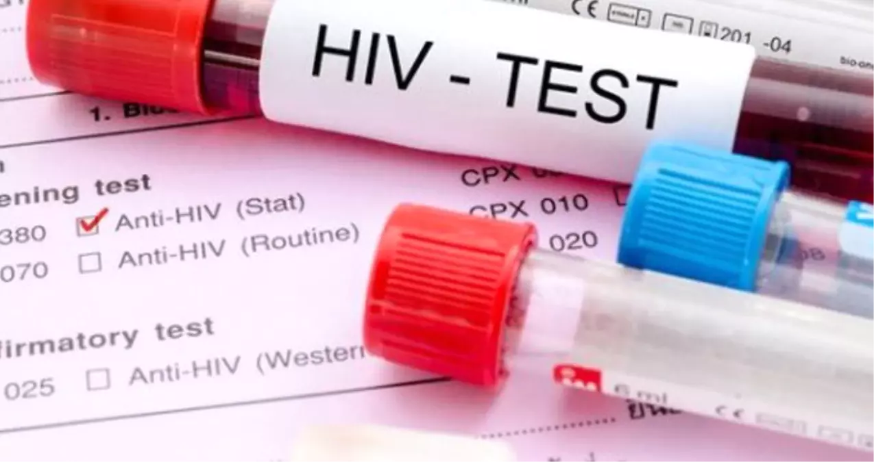 Çin\'de Sağlık Görevlisinin İhmali Yüzünden 5 Hastaya AIDS Bulaştı