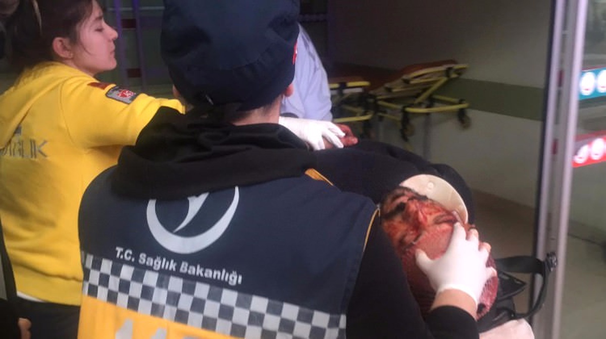 Köpeğini Polislerin Üzerine Salarak Kaçmak İsterken, Başından Vuruldu