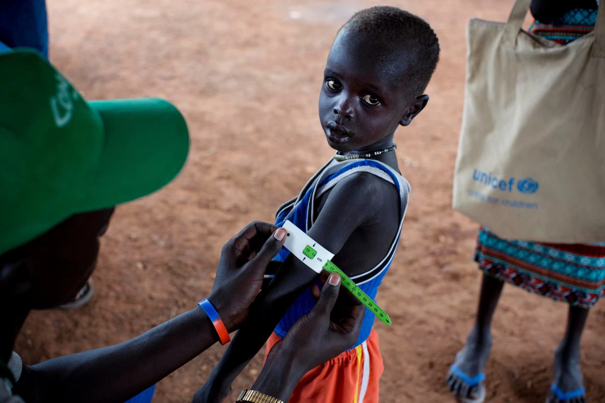 UNICEF: 1,4 Milyon Çocuk Açlıktan Ölebilir