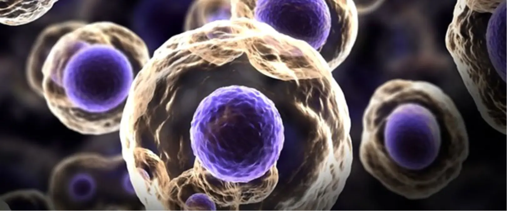 Ege\'de "Melanom ve Melanom Dışı Deri Kanserleri Sempozyumu" düzenlenecek