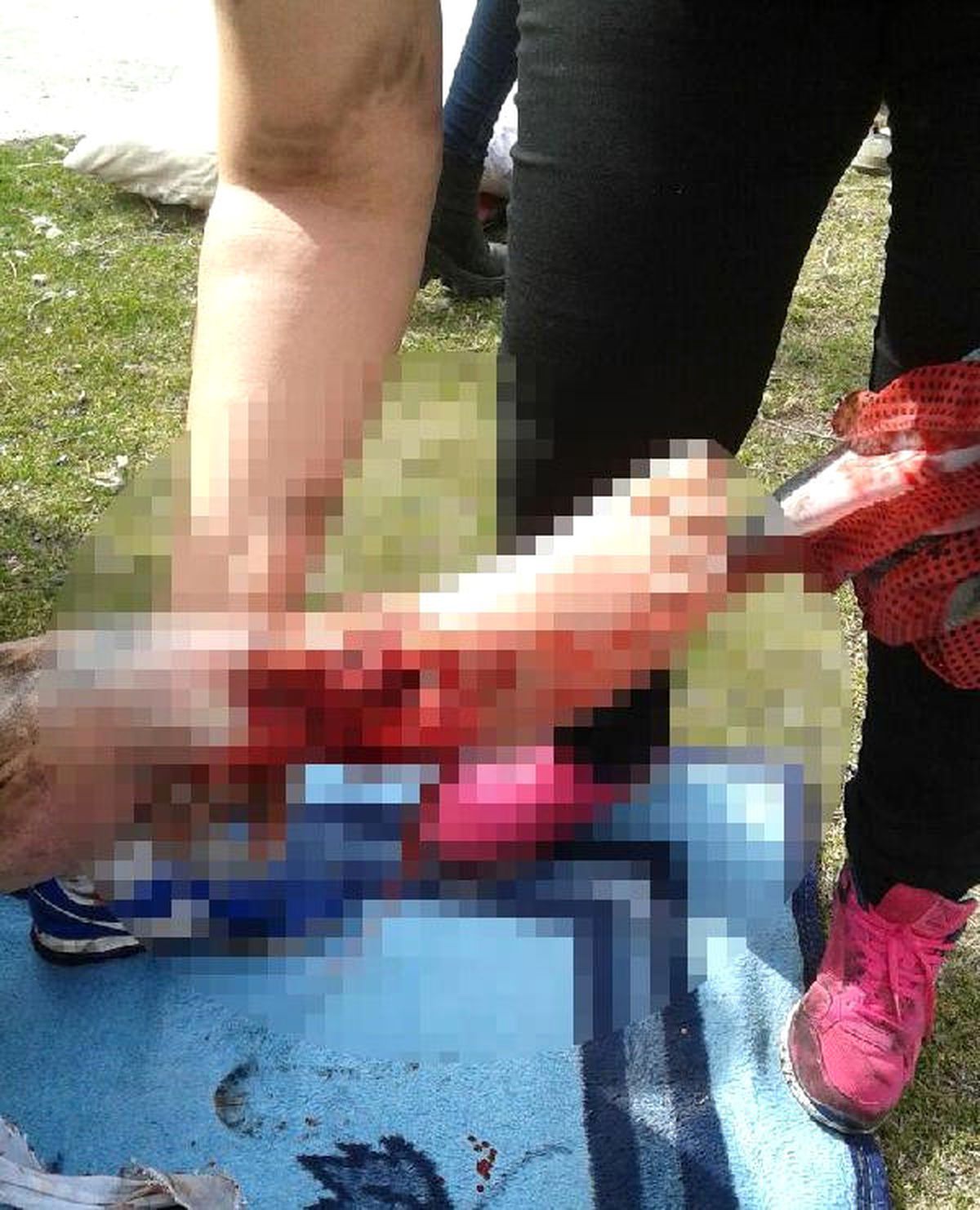 Balık Merakı Ayağından Ediyordu