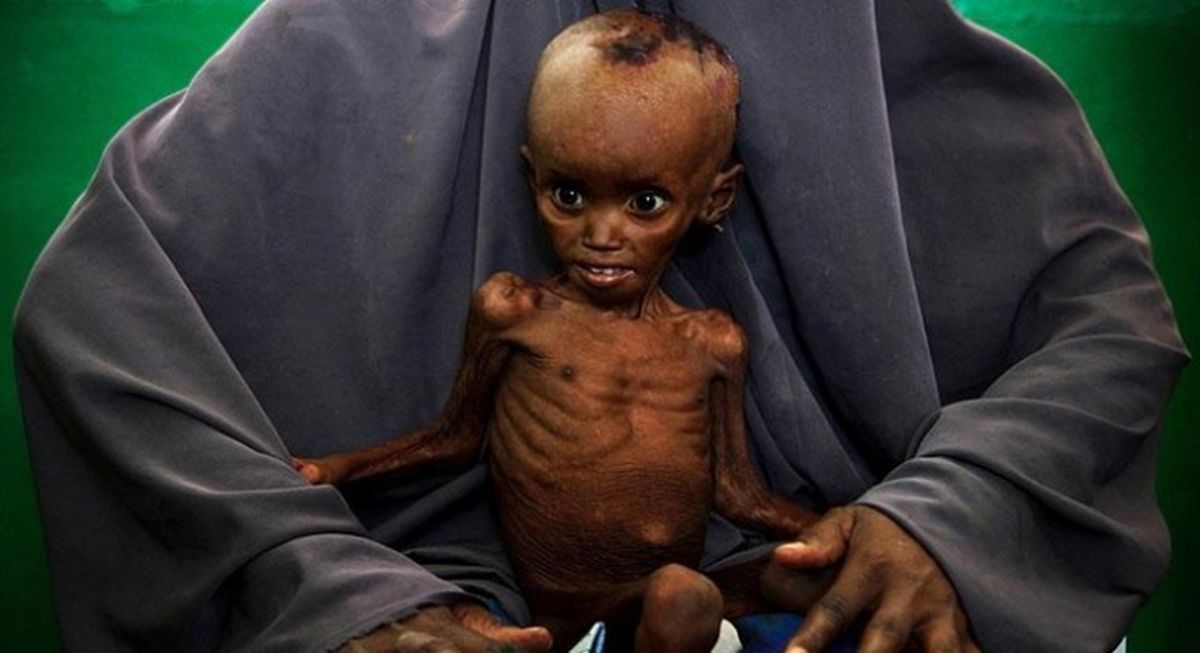 Afrika\'da 20 Milyon Kişi Açlık Tehdidi Altında