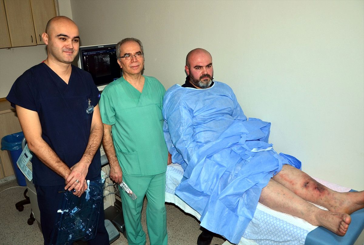 Varis Şikayetine Radyofrekanslı Tedavi