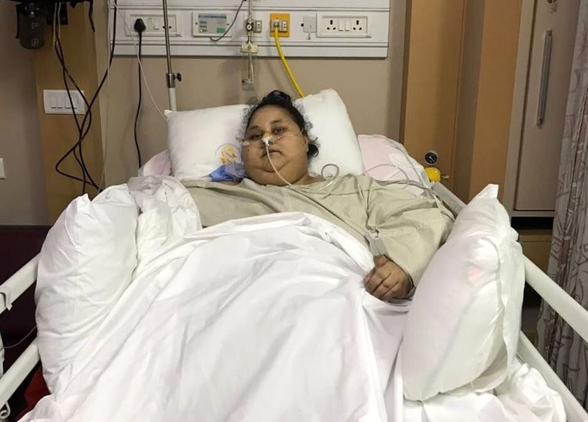 Dünyanın En Kilolu Kadını Ameliyatla 100 Kilo Verdi