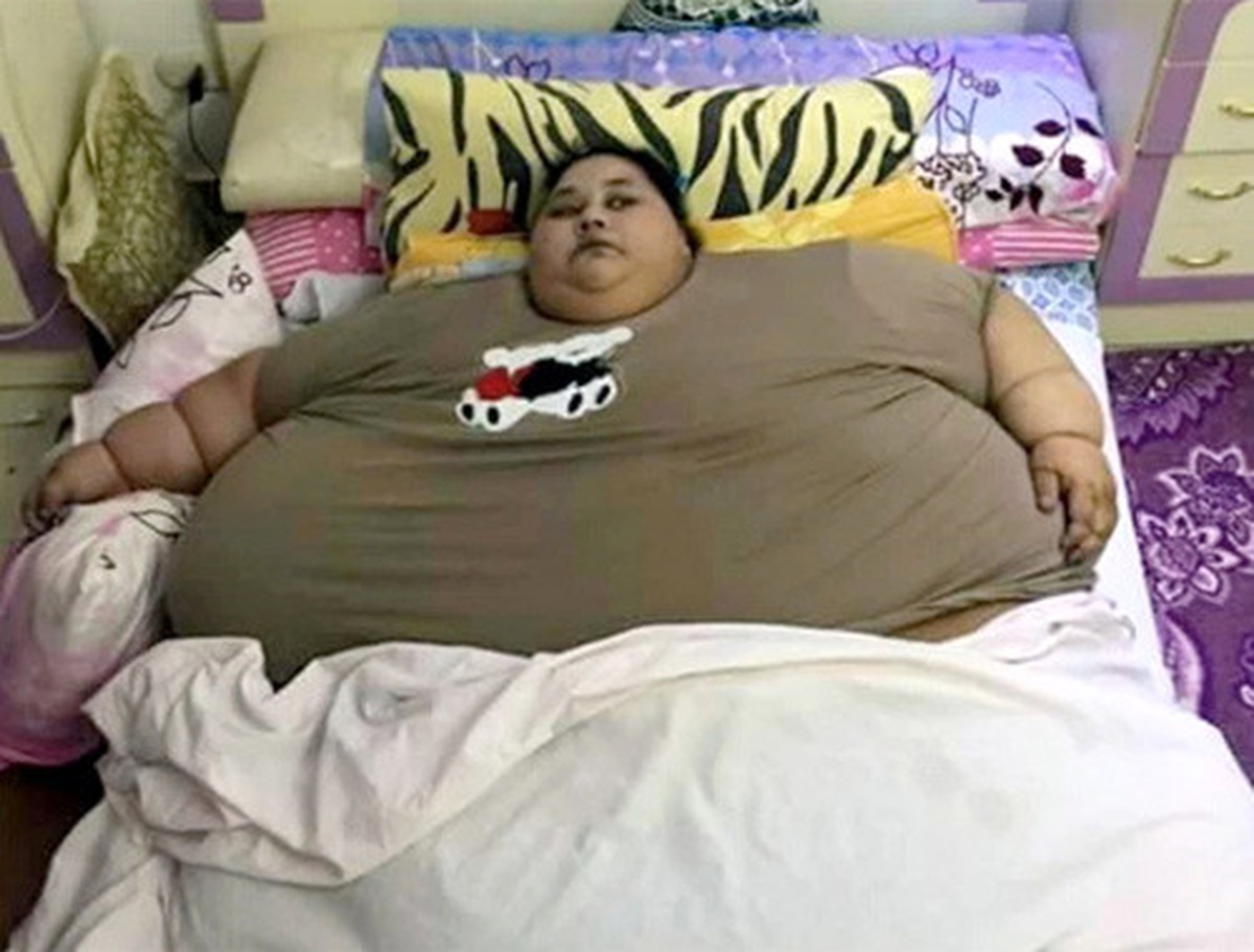 Yarım Tonluk Mısırlı Kadın 100 Kilo Verdi