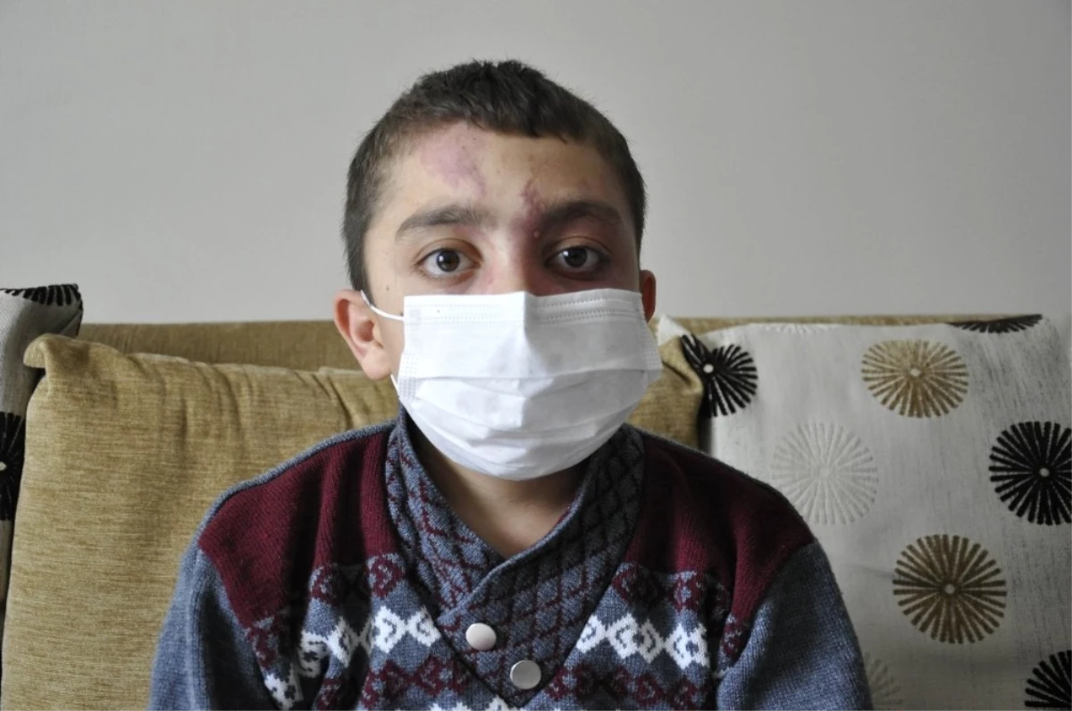 Ölümcül Hastalıklı Çocuk, Tedavi Masraflarının Karşılanmasını İstiyor