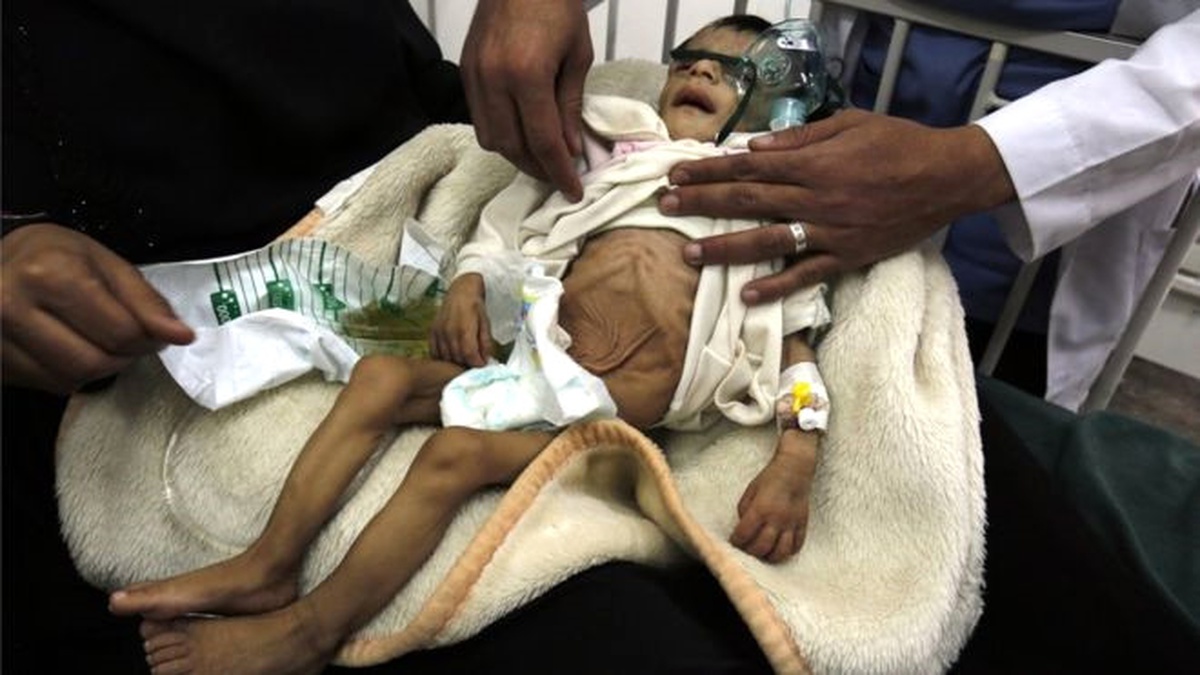 Yemen Savaşında 2 Yılda Bin 500 Çocuk Öldü