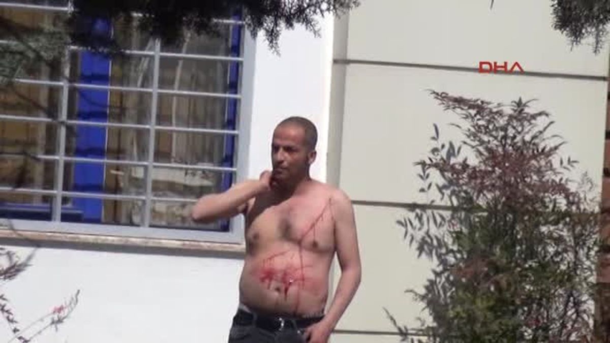 Antalya Tedavi Edilmediğini Iddia Ederek Kendini Kesti