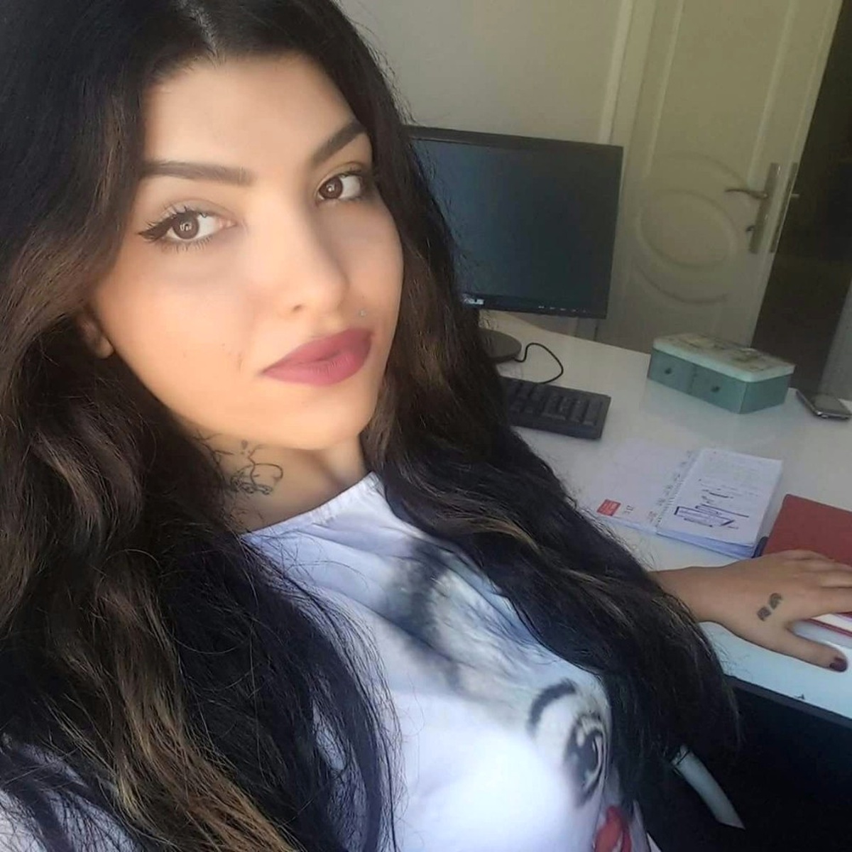 Antalya\'da Otomobilin Önüne Atlayan Genç Kızın Durumu İyiye Gidiyor