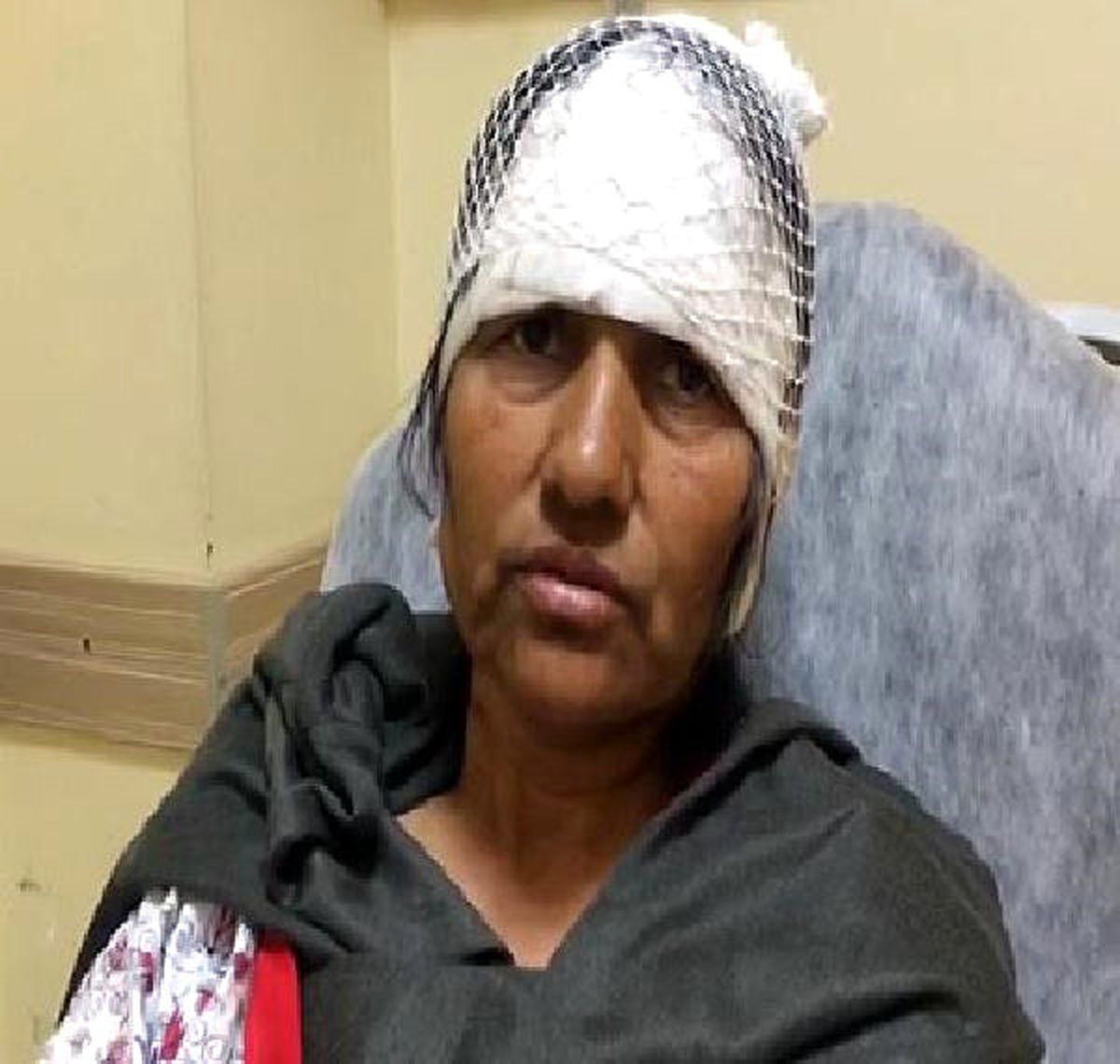 Tarladan Geçen Kadını, 15 Köpek 80 Yerinden Isırdı