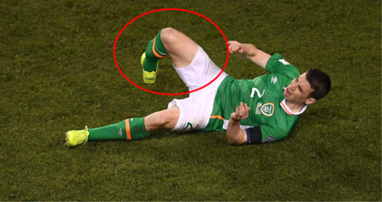 İrlanda Cumhuriyeti\'nde Seamus Coleman\'ın Bacağı Tam Ortadan Kırıldı