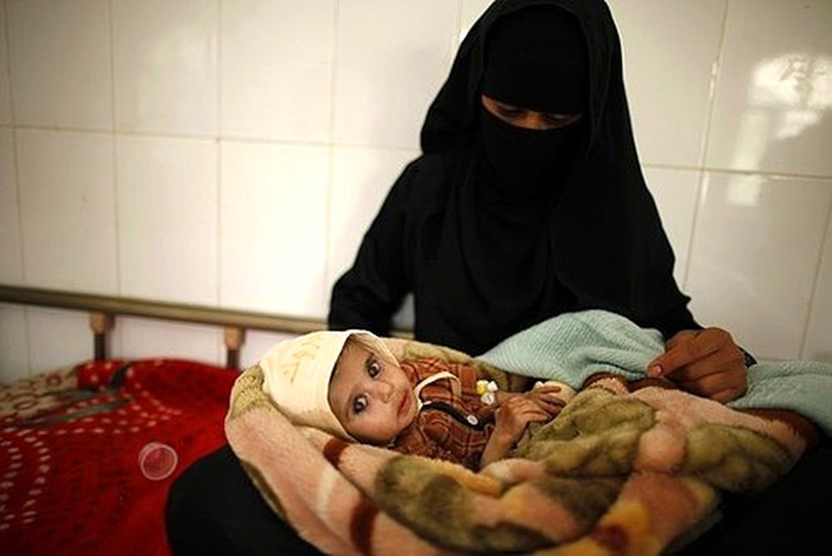 Yemen\'de Savaş Kadınları Vuruyor