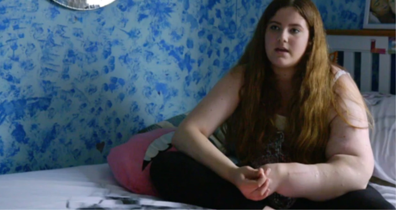 14 Yaşındaki İngiliz Kızın Sol Kolu Hızla Büyüyor