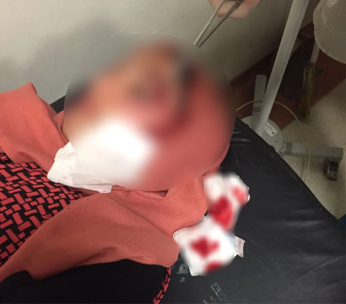 AK Parti\'li Kadınlara Taşlı Saldırı: 2 Yaralı
