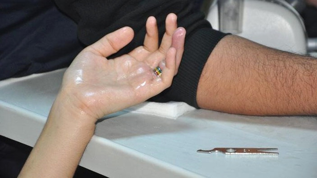 Çocuğun Parmağına Sıkışan Demir Halka İtfaiye Tarafından Çıkartıldı