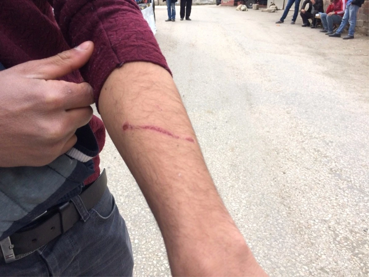 Elazığ\'da Bir Kişiyi Isıran Kuduz Köpek, Tüm Köyü Karantinaya Aldırdı