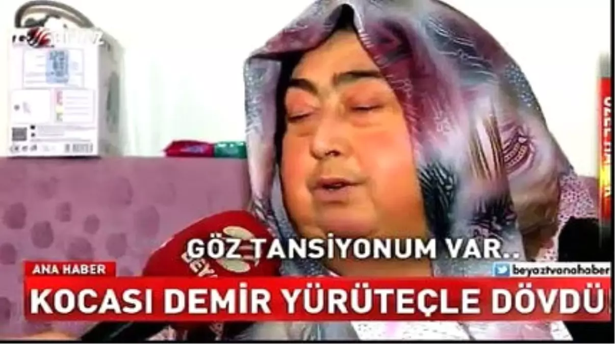 Kocası Demir Yürüteçle Dövdü