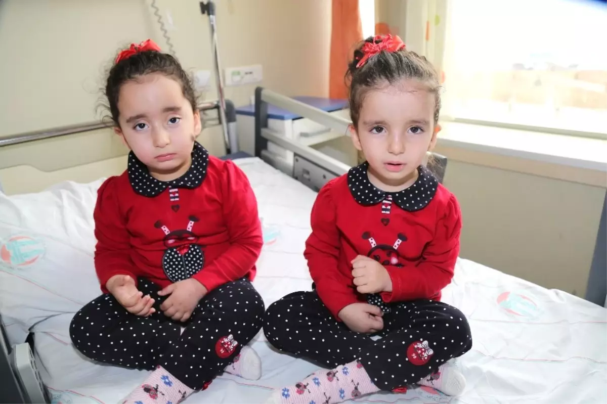 İkizler Ameliyata da Aynı Anda Girdi