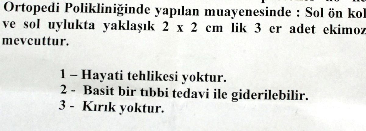 Anaokulunda Bakıcı Anne Şiddeti