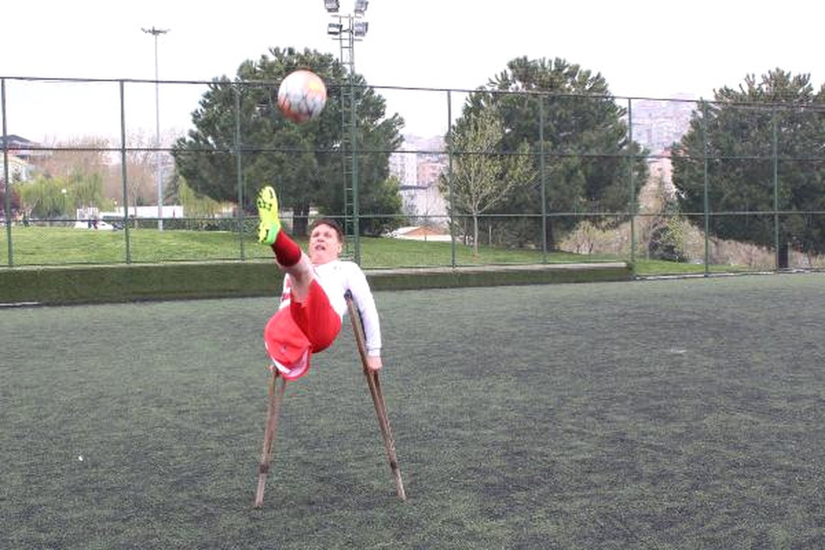 7 Yaşında Sağ Bacağını Kaybetti, Futbolla Zirveye Ulaştı