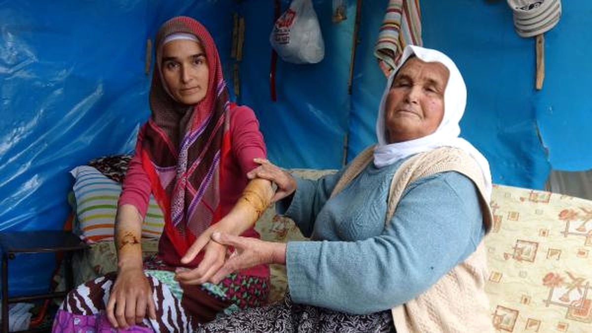 Bahçede Çalışan Kadına Sokak Köpeği Saldırdı