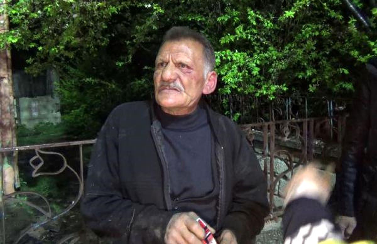 Gece Önce Bacağından Vuruldu, Sonra Evi Yakıldı