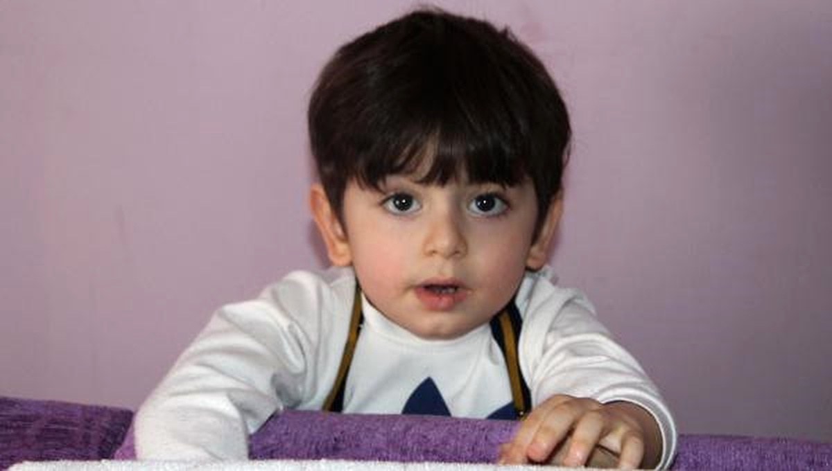 Minik Tufan Gözlerini Kaybetme Tehlikesiyle Karşı Karşıya