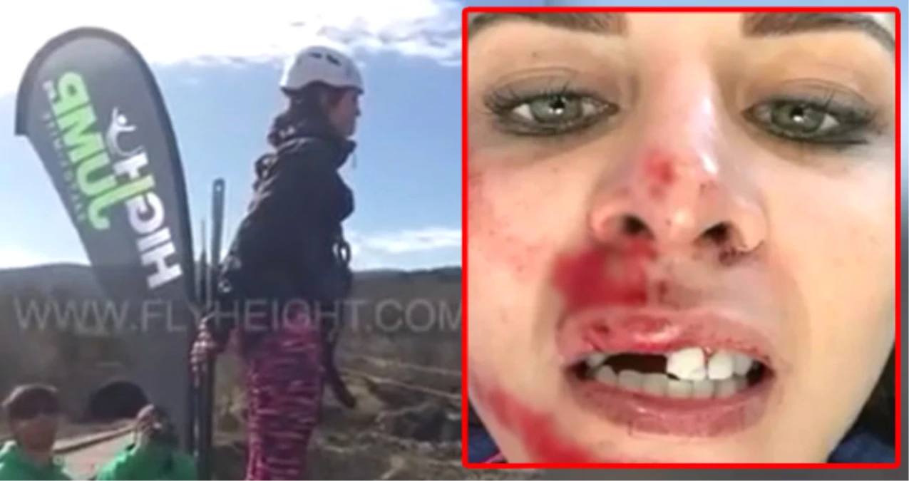 Bungee Jumping Yapmak İsteyen Kadın, İplere Takılınca Dişleri Kırıldı