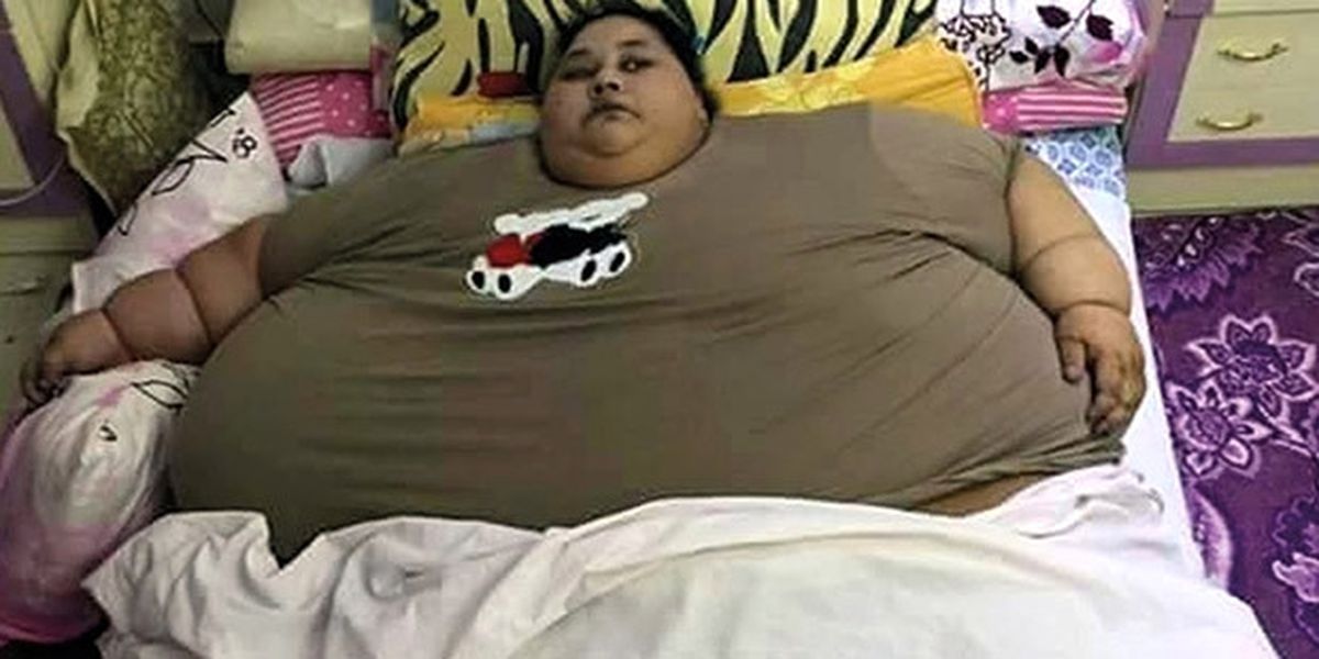 Vinçle Hastaneye Kaldırılmıştı, Ameliyatla 2 Ayda 242 Kilo Verdi