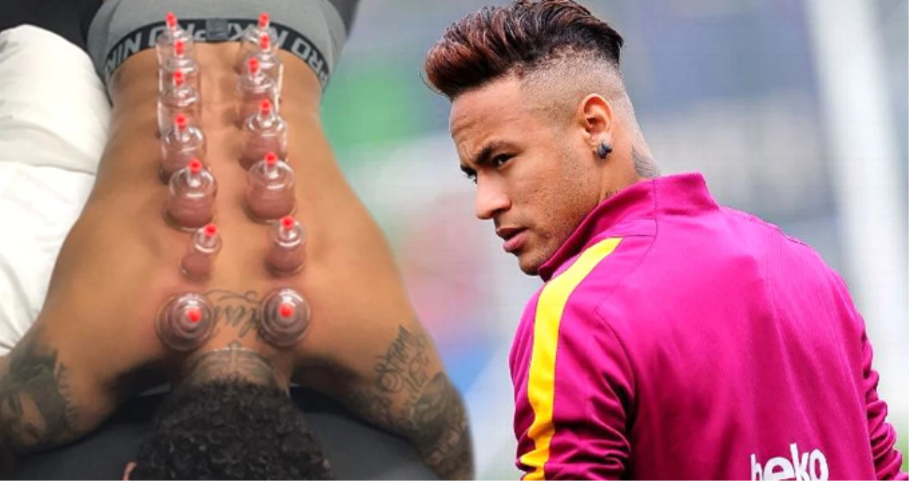 Barcelonalı Neymar, Bardak Çekme Tedavisini Uyguladı