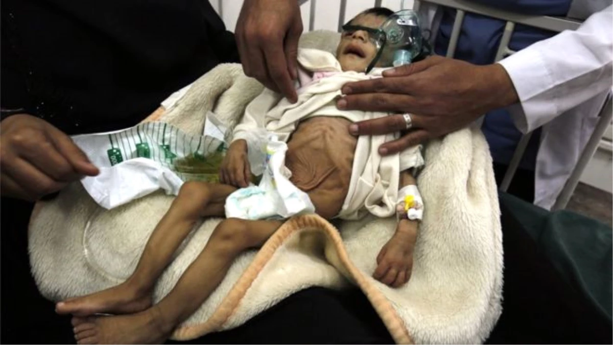Yemen\'de Yarım Milyon Çocuk Ölüm Tehlikesiyle Karşı Karşıya