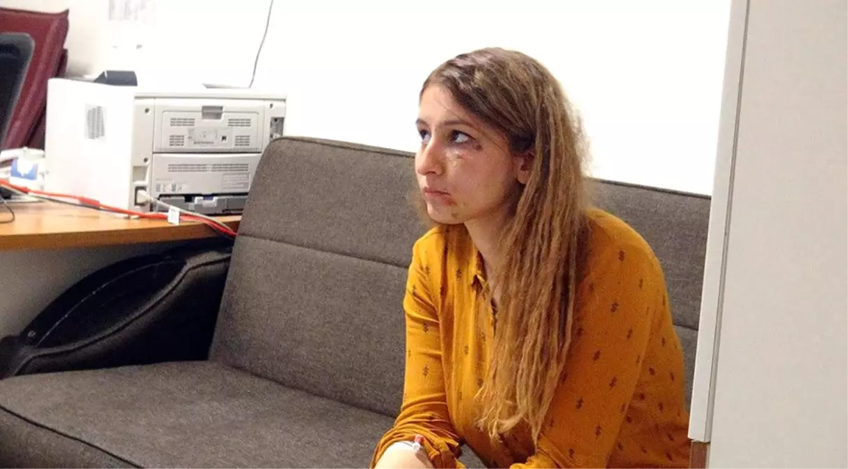 Mardin\'de Kuaför, Saçını Yaktığını Söyleyen Kadın Polisi Dövdü