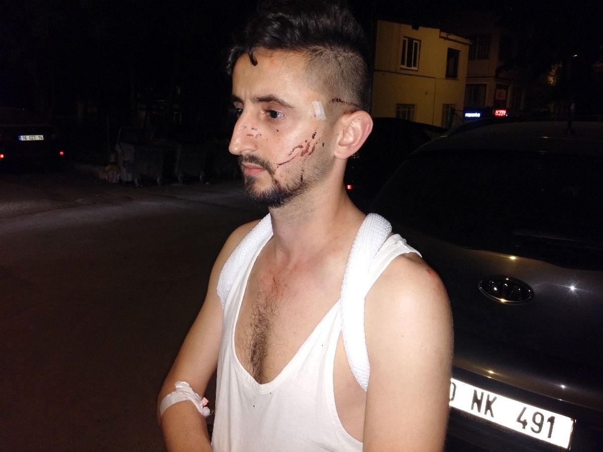 Otobüs Şoförü Imdat Çekiciyle Dövdü
