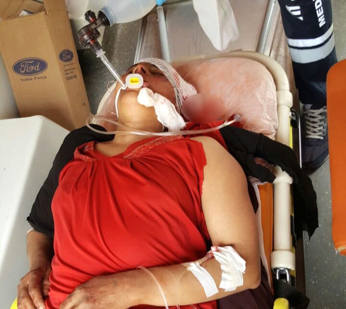 Pkk/pyd Sivilleri Vurmaya Devam Ediyor