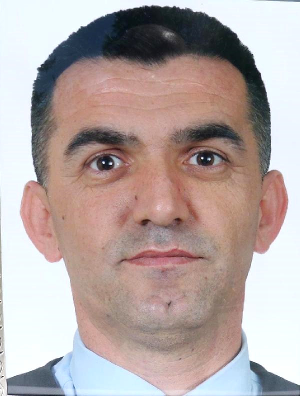 4 Dişi Çekildikten Sonra Ölen Polisin Dosyası Bilirkişide