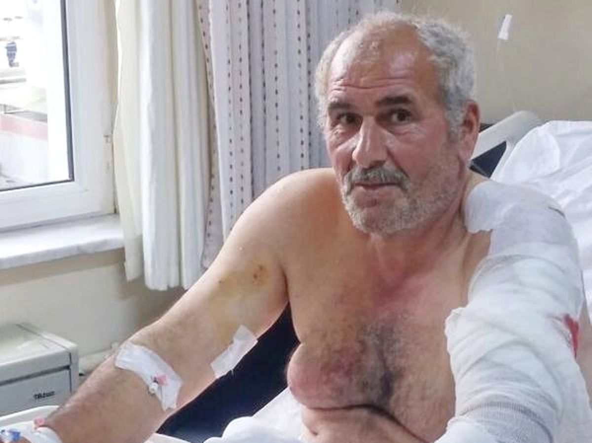 Ayı Saldırısına Uğrayan Vatandaş Yaralı Kurtuldu