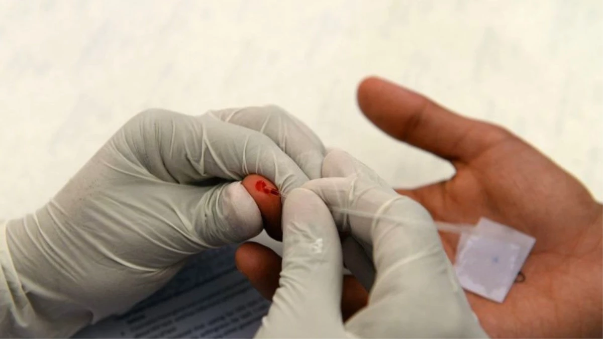 Araştırma: HIV Virüsü Kapan Biri Artık 78 Yaşına Kadar Yaşayabilir