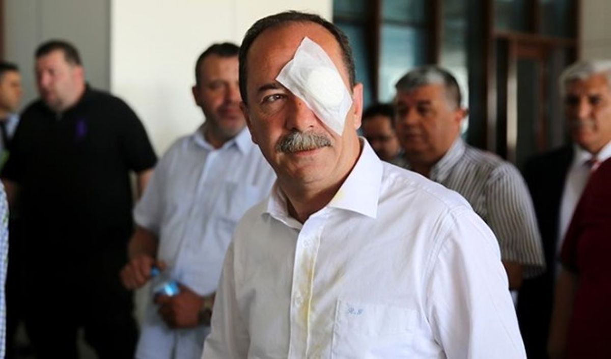 Belediye Başkanına Yumruklu Saldırı